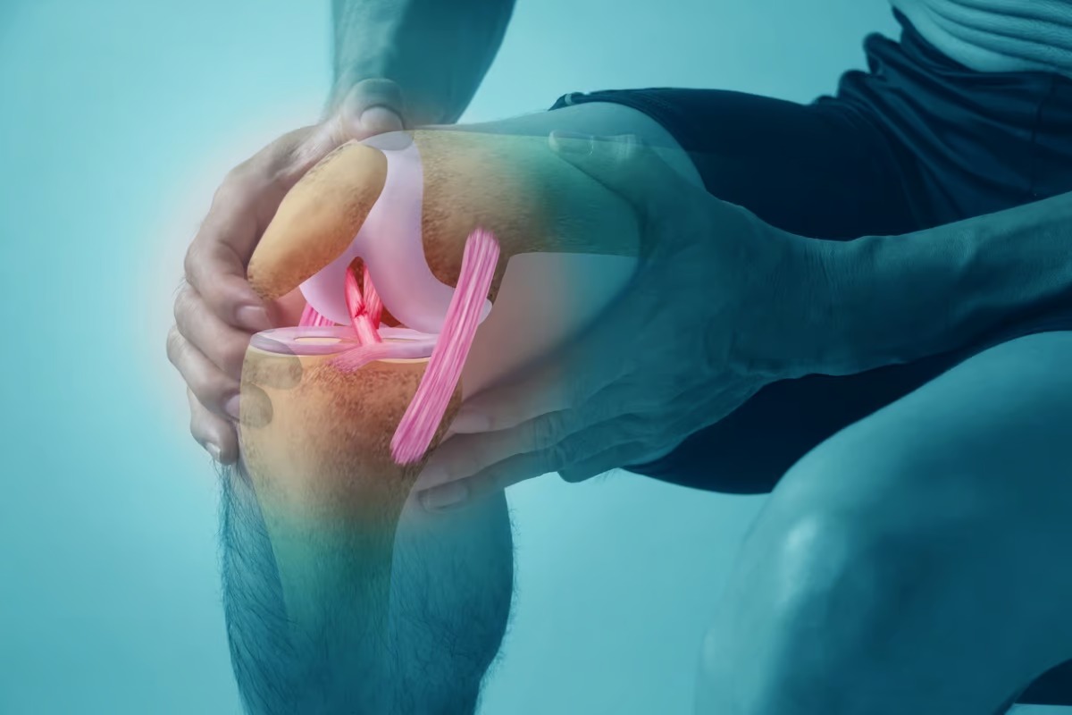 ACL Tear