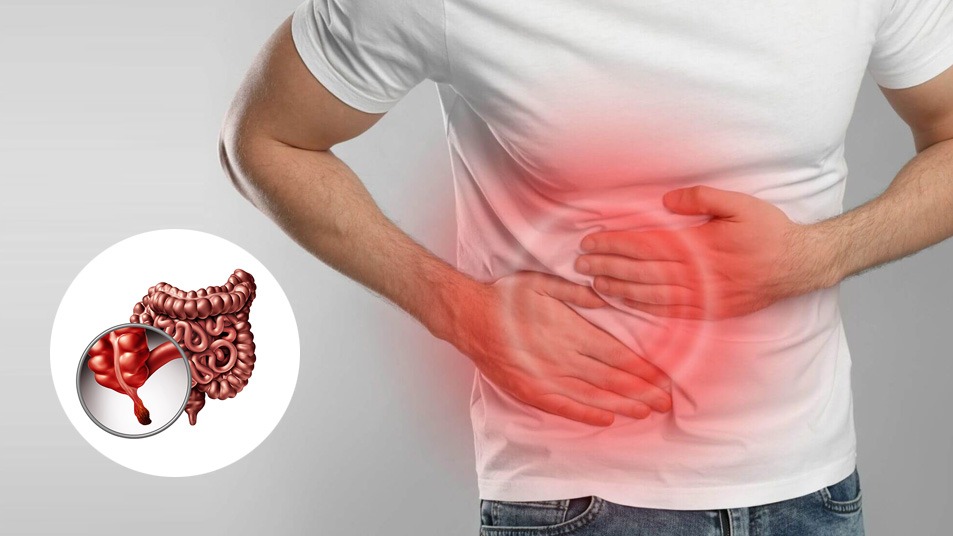 Appendectomy